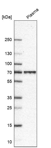 Analysis in human plasma.