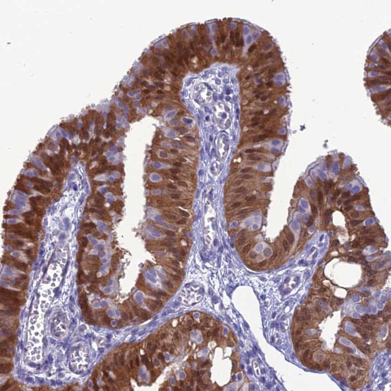 Immunohistochemistry-Paraffin GNPNAT1 Antibody - BSA Free