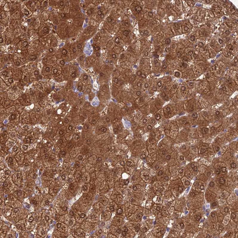 Immunohistochemistry-Paraffin GNPNAT1 Antibody - BSA Free