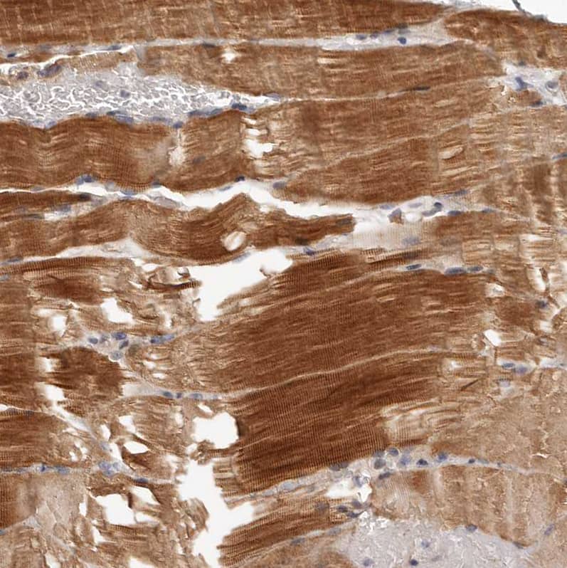 Immunohistochemistry-Paraffin MRPS10 Antibody - BSA Free