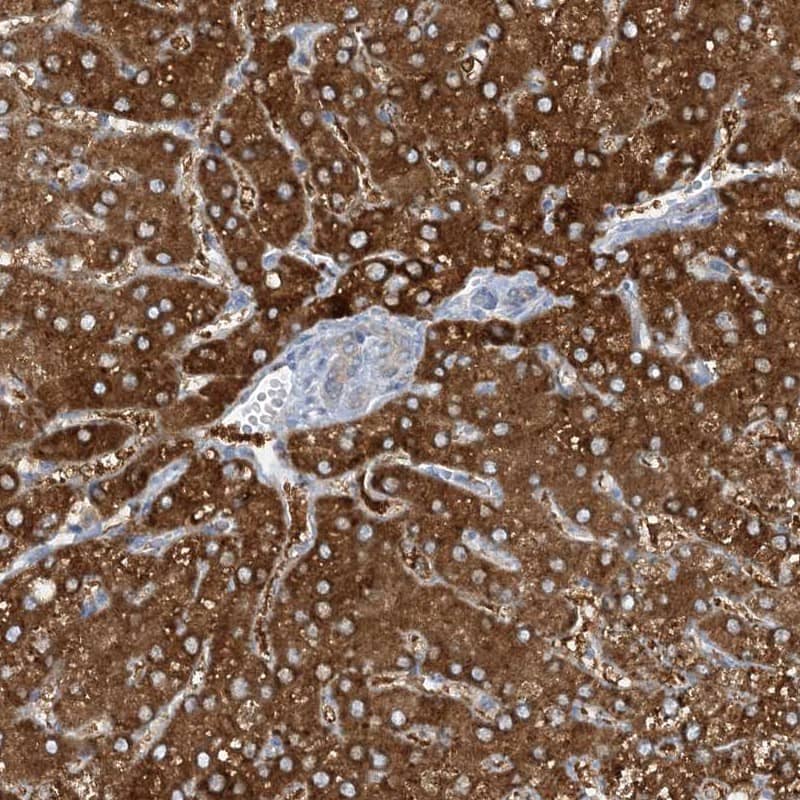 Staining of human liver shows strong cytoplasmic positivity in hepatocytes.