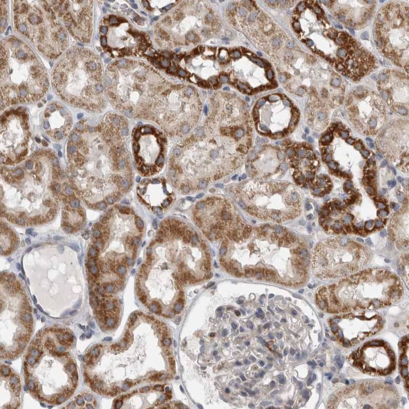 Staining of human kidney shows moderate cytoplasmic positivity in cells in tubules.