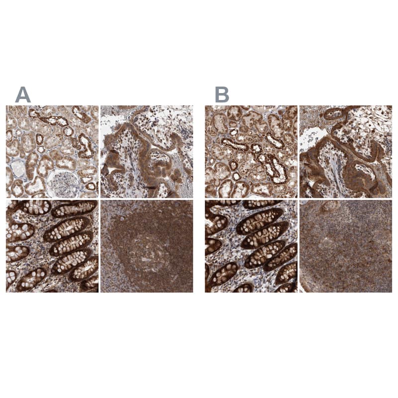 <b>Independent Antibodies Validation. </b>Staining of human kidney, placenta, rectum and tonsil using Anti-DARS2 antibody NBP1-83854 (A) shows similar protein distribution across tissues to independent antibody NBP1-83855 (B).