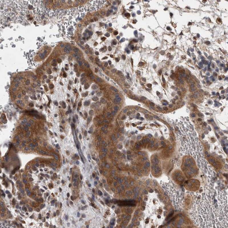 Staining of human placenta shows moderate cytoplasmic positivity in trophoblastic cells.