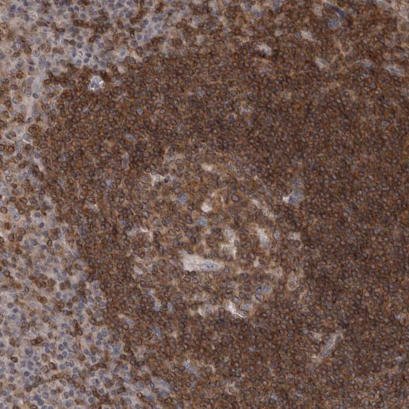 Staining of human tonsil shows moderate cytoplasmic-membranous positivity in non-germinal center cells and germinal center cells.