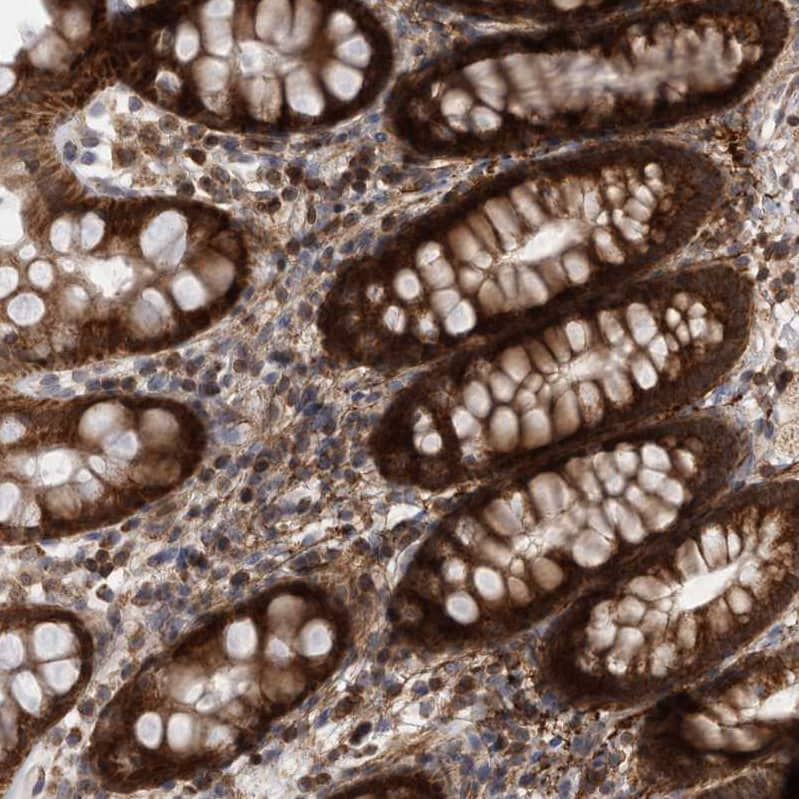 Staining of human rectum shows strong cytoplasmic positivity in glandular cells.