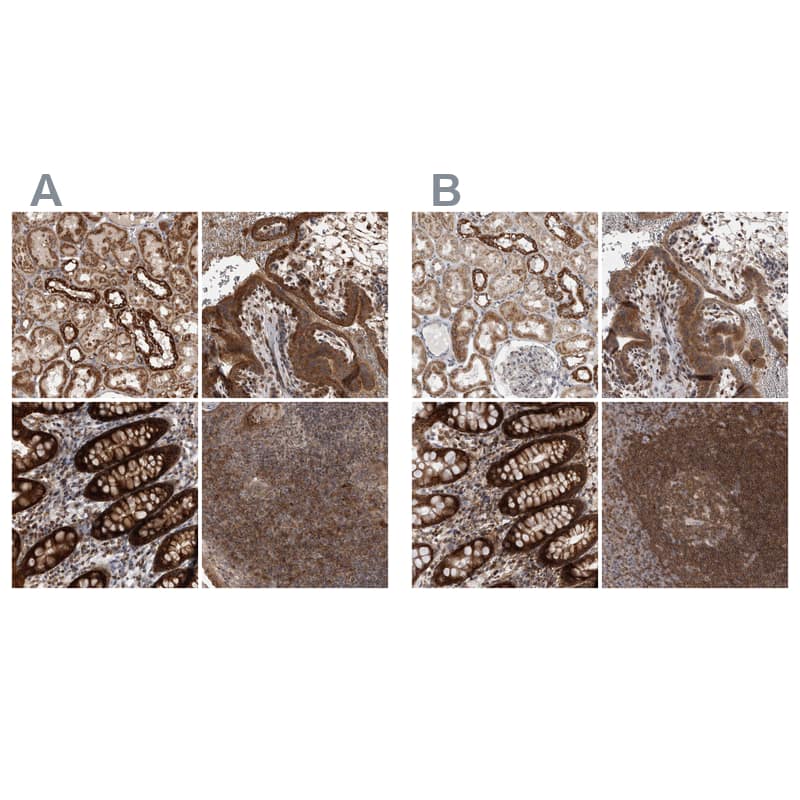 <b>Independent Antibodies Validation. </b>Staining of human kidney, placenta, rectum and tonsil using Anti-DARS2 antibody NBP1-83855 (A) shows similar protein distribution across tissues to independent antibody NBP1-83854 (B).