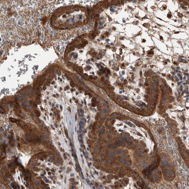 <b>Independent Antibodies Validation. </b>Staining of human placenta shows moderate cytoplasmic positivity in trophoblastic cells.