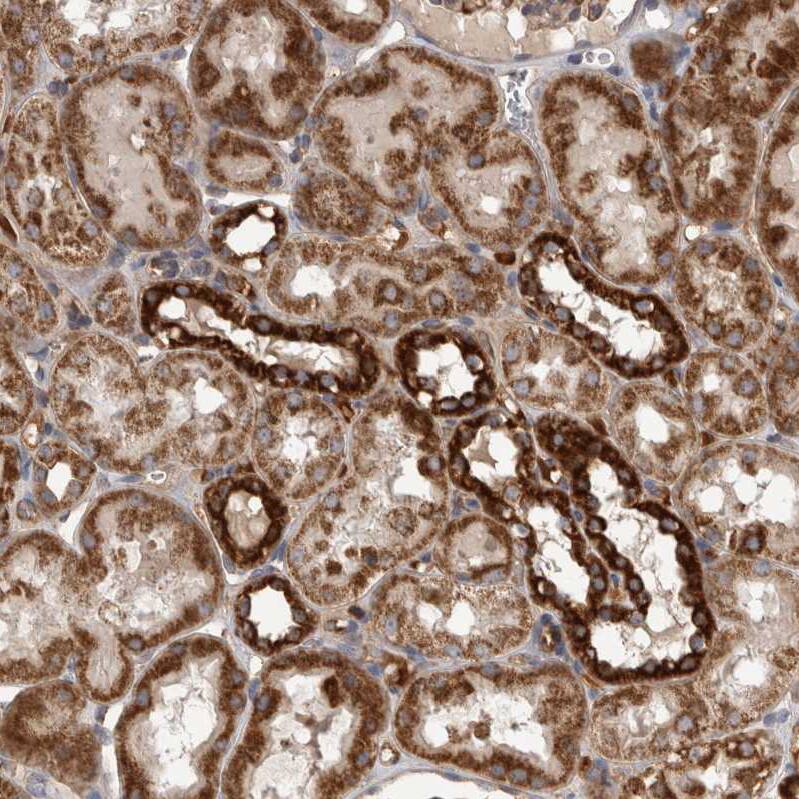 Staining of human kidney shows strong cytoplasmic positivity in cells in tubules.