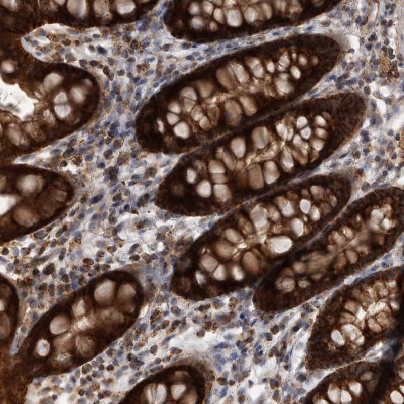 Staining of human rectum shows strong cytoplasmic positivity in glandular cells.