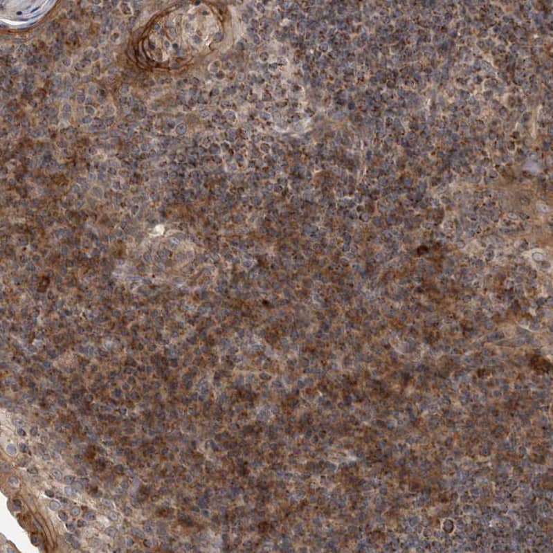 Staining of human lymphoid tissues shows moderate cytoplasmic positivity in non-germinal center cells.