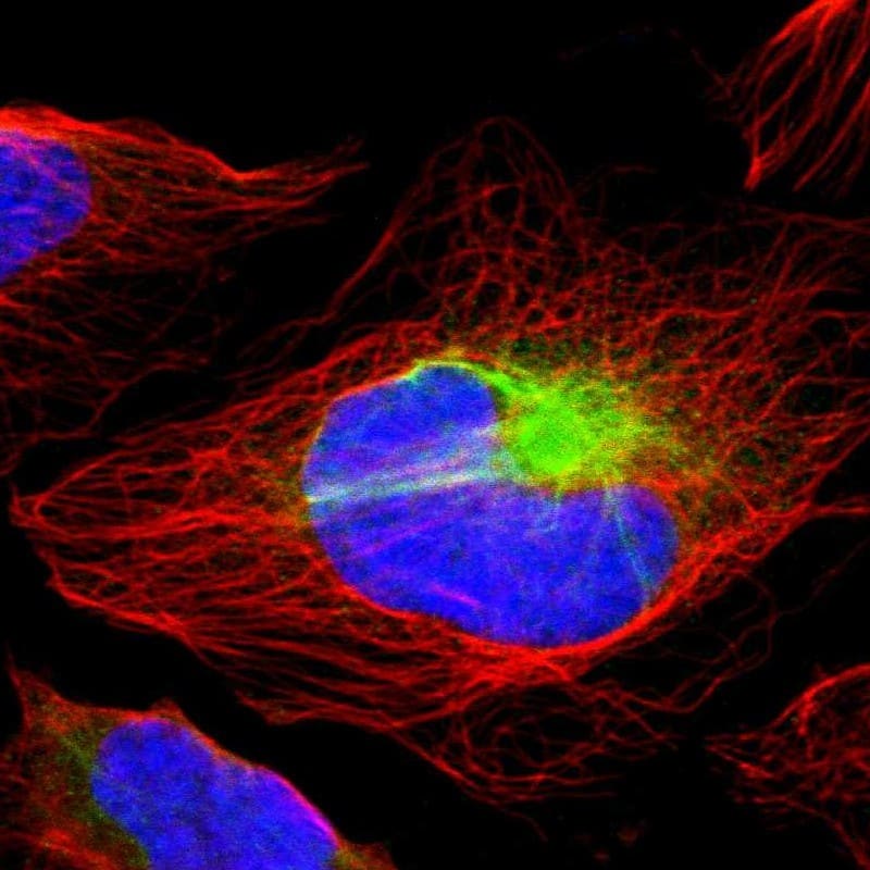Staining of human cell line U-2 OS shows localization to intermediate filaments.