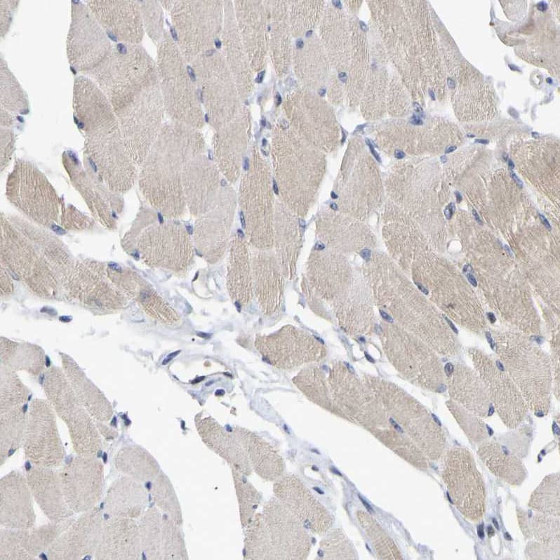 Immunohistochemistry-Paraffin NLE1 Antibody - BSA Free