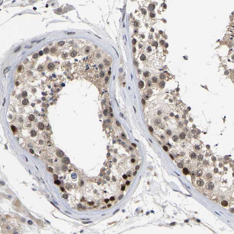 Immunohistochemistry-Paraffin NLE1 Antibody - BSA Free