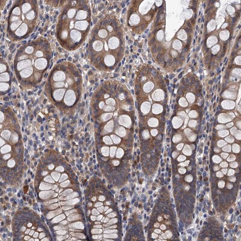 Staining of human colon shows moderate cytoplasmic positivity in glandular cells.