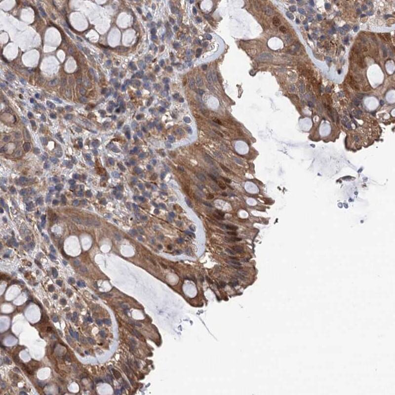 Staining of human rectum shows moderate cytoplasmic and nuclear positivity in glandular cells.