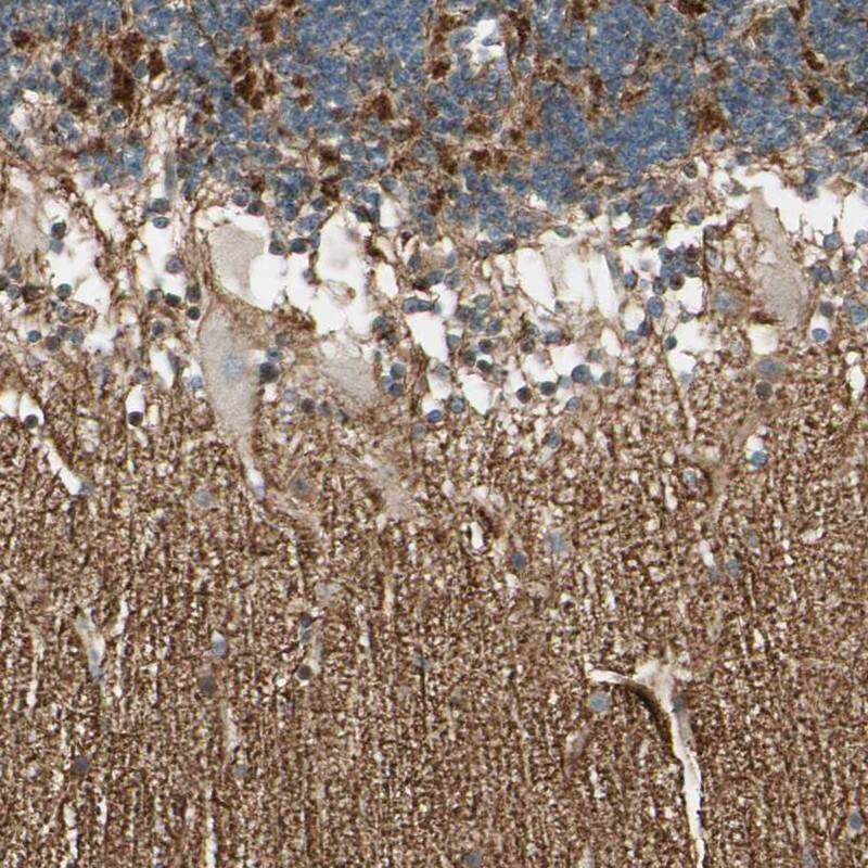 Staining of human cerebellum shows weak cytoplasmic positivity in Purkinje cells.
