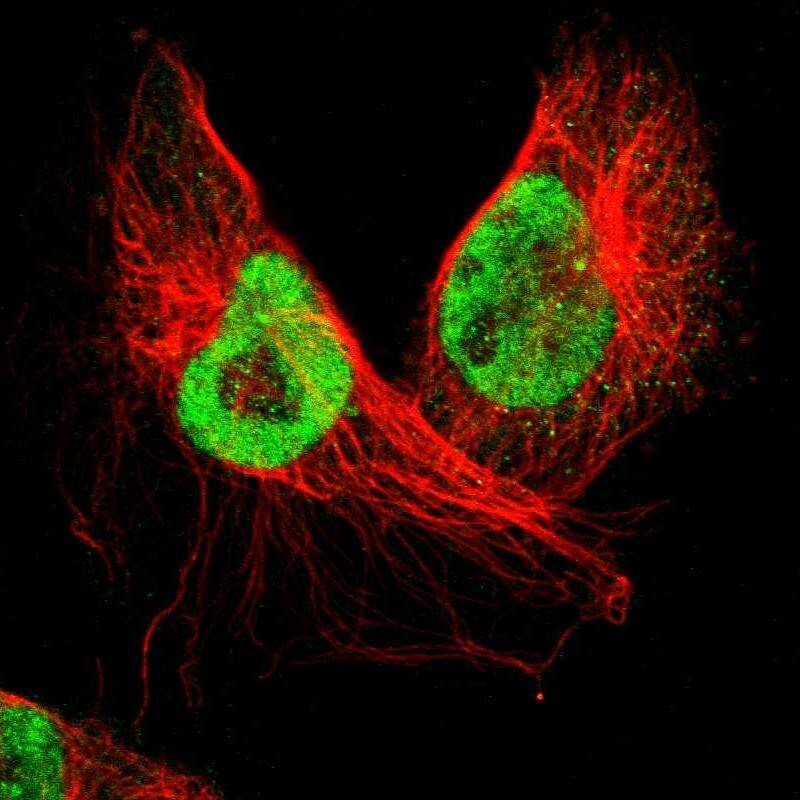 Immunocytochemistry/ Immunofluorescence SMEK2 Antibody - BSA Free