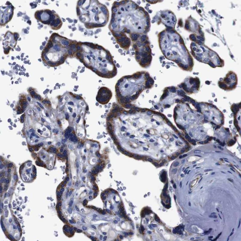 Immunohistochemistry-Paraffin FKBP9 Antibody - BSA Free