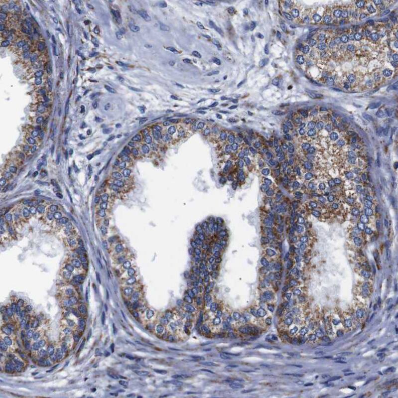 Staining of human prostate shows moderate granular cytoplasmic positivity in glandular cells.