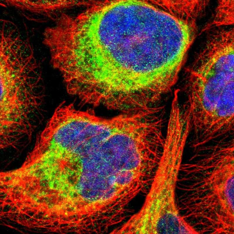 Staining of human cell line A-431 shows localization to endoplasmic reticulum.