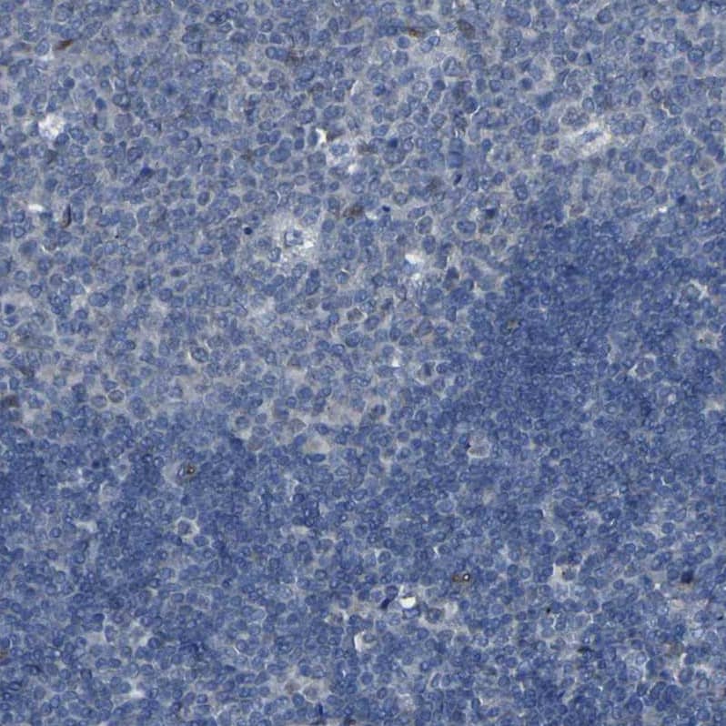 Immunohistochemistry-Paraffin LRRN1/NLRR-1 Antibody - BSA Free