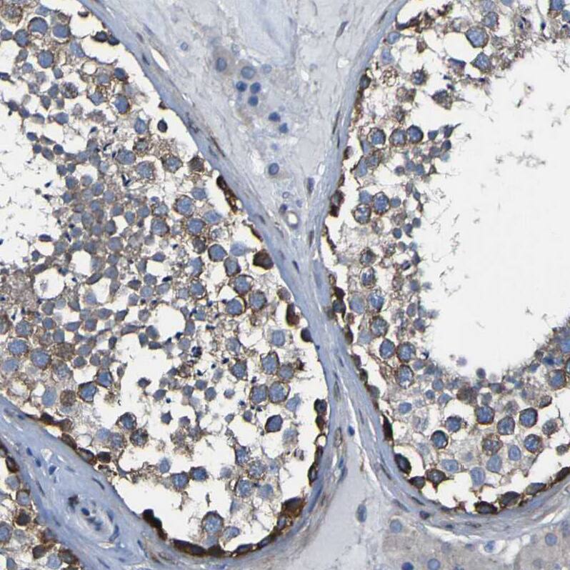 Staining of human testis shows strong membranous positivity in cells in seminiferous ducts.