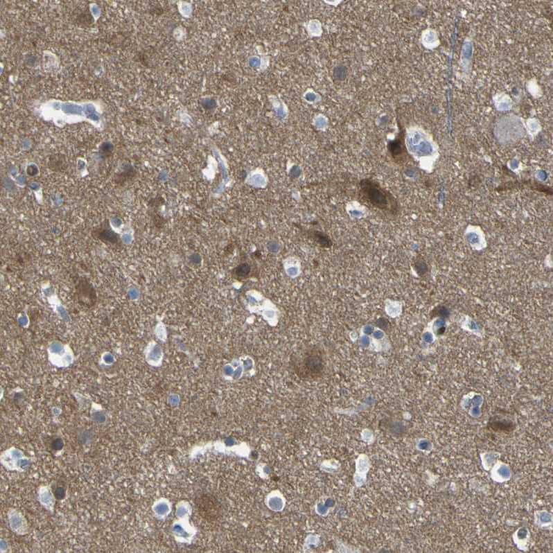 Staining of human cerebral cortex shows strong cytoplasmic positivity in neurons.