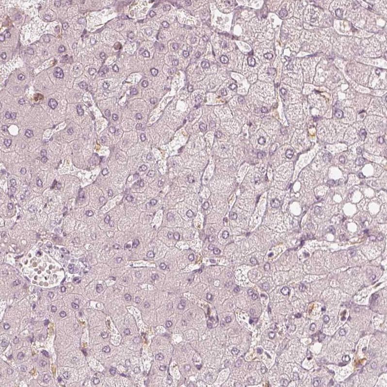 Staining of human liver shows no positivity in hepatocytes as expected.