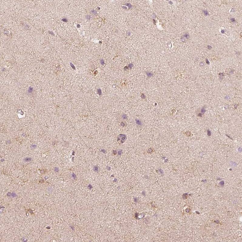Staining of human cerebral cortex shows moderate cytoplasmic positivity in glial cells.