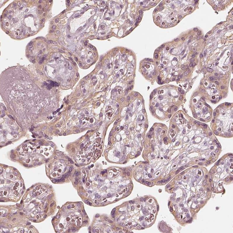 Staining of human placenta shows weak cytoplasmic positivity in trophoblastic cells.