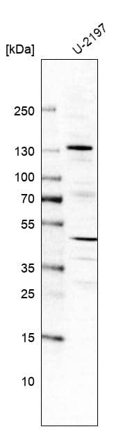Analysis in human cell line U-2197.