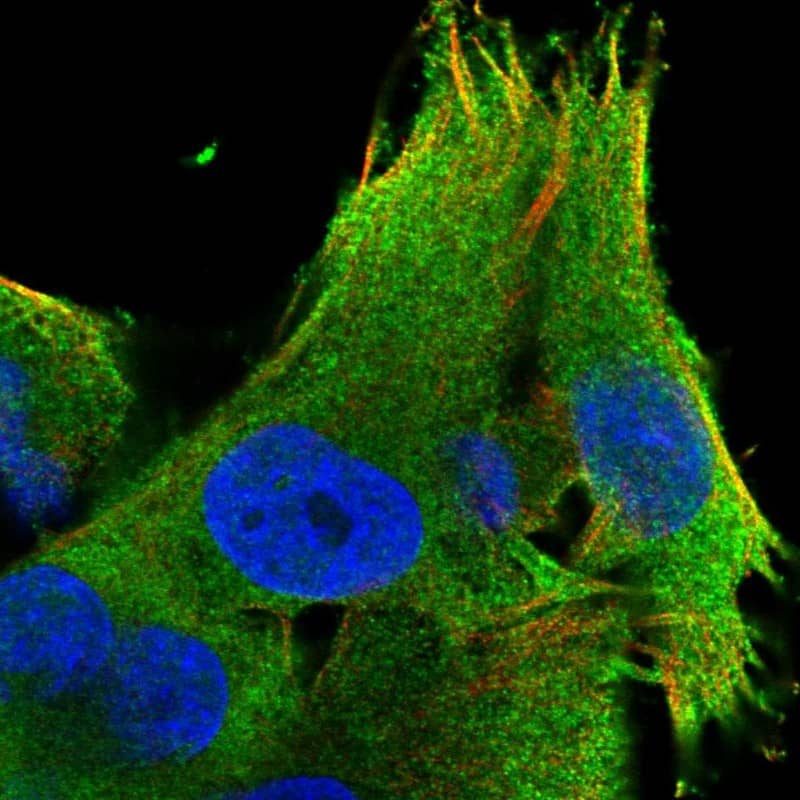 Staining of human cell line SK-MEL-30 shows localization to plasma membrane.