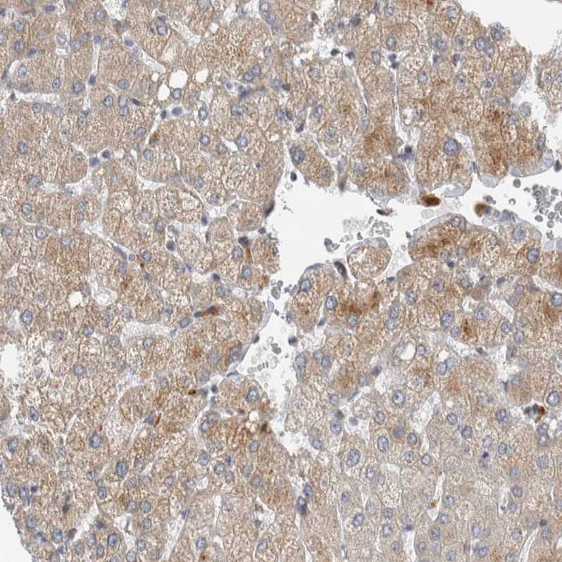 Staining of human Liver shows moderate cytoplasmic positivity in hepatocytes.