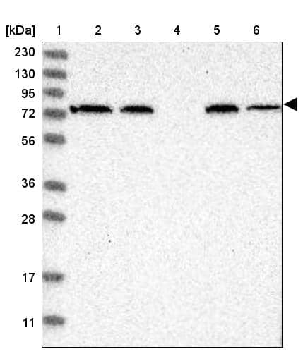 Lane 1: Marker [kDa] 230, 130, 95, 72, 56, 36, 28, 17, 11Lane 2: Human cell line RT-4Lane 3: Human cell line U-251MG spLane 4: Human plasma (IgG/HSA depleted)Lane 5: Human liver tissueLane 6: Human tonsil tissue