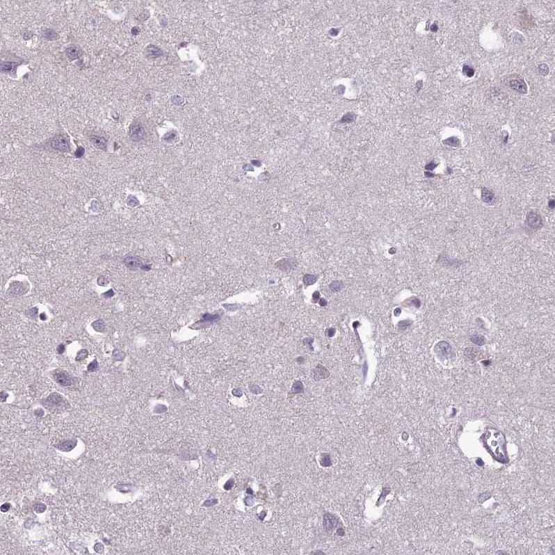 Staining of human cerebral cortex shows no cytoplasmic positivity in neuronal cells as expected.