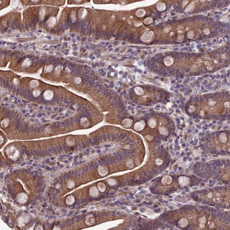 Immunohistochemistry-Paraffin FBRS Antibody - BSA Free