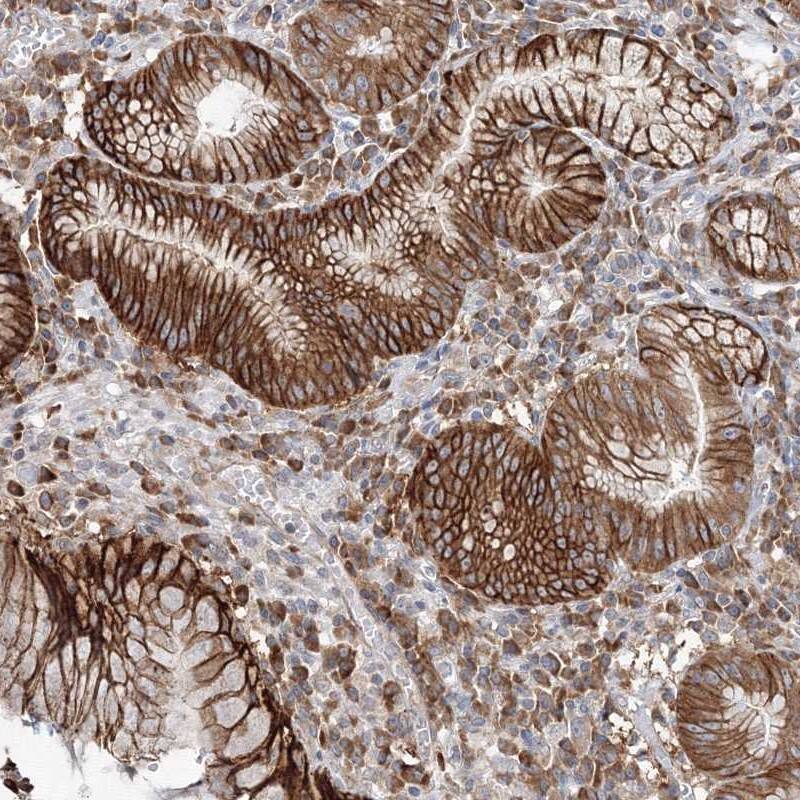 Immunohistochemistry-Paraffin Fbxl8 Antibody - BSA Free