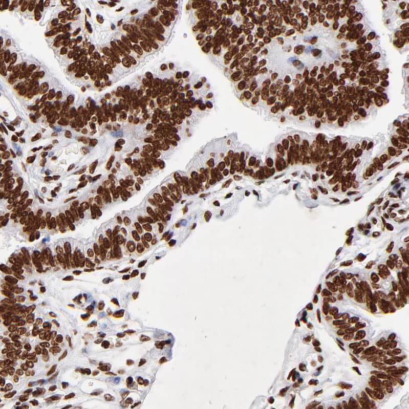 Immunohistochemistry-Paraffin FBXO18 Antibody - BSA Free