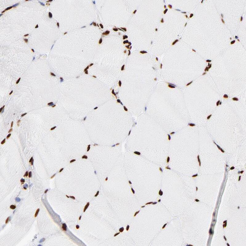 Immunohistochemistry-Paraffin FBXO18 Antibody - BSA Free