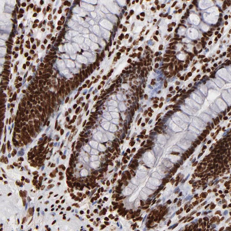 Immunohistochemistry-Paraffin FBXO18 Antibody - BSA Free