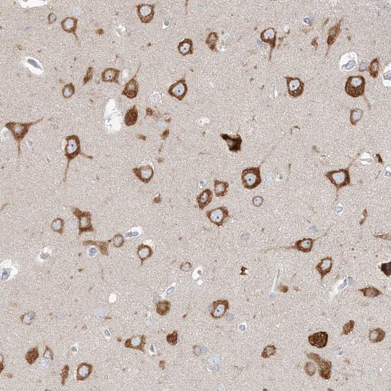 Staining of human cerebral cortex shows strong cytoplasmic positivity in neuronal cells.