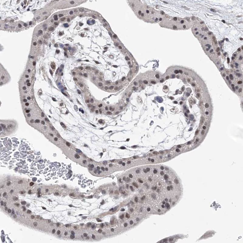 Staining of human placenta shows moderate nuclear positivity in trophoblastic cells.