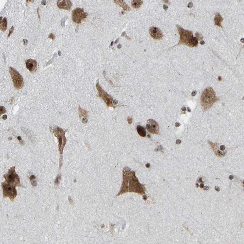 Staining of human cerebral cortex shows strong cytoplasmic and nuclear positivity in neuronal cells.