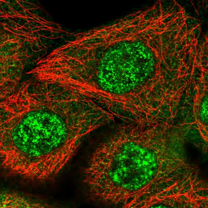 Immunocytochemistry/ Immunofluorescence ZNF160 Antibody - BSA Free