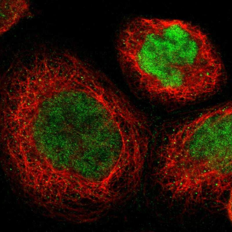 Staining of human cell line A-431 shows localization to nucleoplasm.