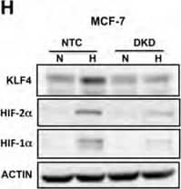 Western Blot: KLF4 Antibody [NBP1-83940] - HIFs are required for hypoxia-induced expression of pluripotency factorsA-C. Breast cancer cell lines were exposed to 20% or 1% O2 for 24 h & NANOG (A), KLF4 (B), & SOX2 (C) mRNA levels were determined by RT-qPCR, relative to 18S rRNA, & normalized to the mean value for MDA-MB-231 cells (MDA231) at 20% O2 (mean ± SEM; n = 3). *P < 0.05, **P < 0.01, ***P < 0.001 vs. same cell line at 20% O2 by Student's t test. D & E. HCC-1954 (D) & MCF-7 (E) subclones, which were stably transfected with an expression vector encoding a non-targeting control (NTC) shRNA, or vector encoding shRNA targeting HIF-1 alpha  (sh1 alpha ) or HIF-2 alpha  (sh2 alpha ), or vectors encoding shRNAs targeting both HIF-1 alpha  & HIF-2 alpha  (DKD), were exposed to 20% or 1% O2 for 24 h & RT-qPCR was performed to determine NANOG (D) or KLF4 (E) mRNA levels relative to 18S rRNA. The results were normalized to NTC at 20% O2 (mean ± SEM; n = 3). *P < 0.05, **P < 0.01, ***P < 0.001 vs. NTC at 20% O2; #P < 0.05, ##P < 0.01, ###P < 0.001 vs. NTC at 1% O2 by ANOVA. F. ZR75.1 cells treated with vehicle or digoxin (200 nM) were exposed to 20% or 1% O2 for 24 h & SOX2 mRNA was measured (mean ± SEM; n = 3). *P < 0.05, **P < 0.01 vs. NTC at 20% O2; ###P < 0.001 vs. NTC at 1% O2 by ANOVA. G & H. NTC & DKD subclones of HCC-1954 (G) & MCF-7 (H) were exposed to 20% or 1% O2 for 48 h, whole cell lysates were prepared, & immunoblot assays were performed to analyze HIF-1 alpha , HIF-2 alpha , NANOG & KLF4 protein expression. Actin was also analyzed as a loading control. I. ZR75.1 cells were treated with vehicle or digoxin (200 nM), exposed to 20% or 1% O2 for 48 h, & HIF-1 alpha , NANOG & SOX2 immunoblot assays were performed. Image collected & cropped by CiteAb from the following publication (//www.oncotarget.com/lookup/doi/10.18632/oncotarget.11743), licensed under a CC-BY license. Not internally tested by Novus Biologicals.