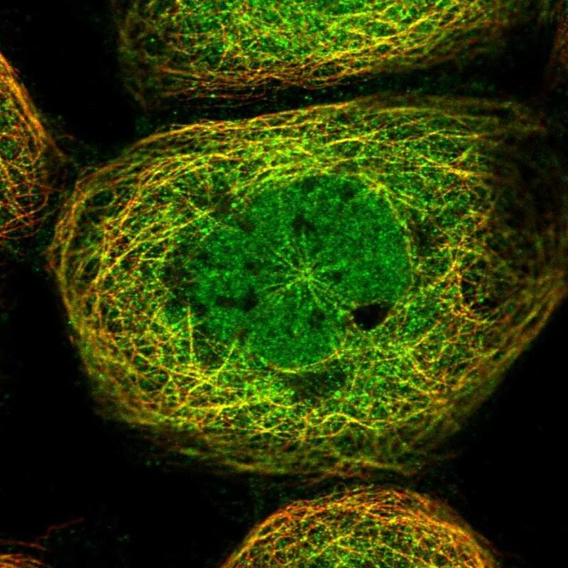 Staining of human cell line A-431 shows localization to nucleoplasm & microtubules.
