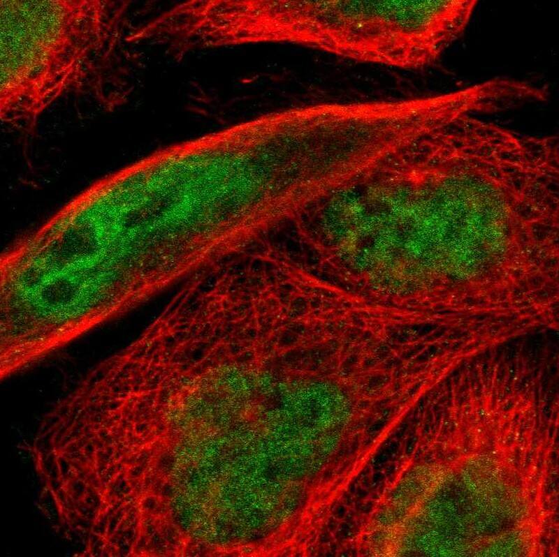 Staining of human cell line A-431 shows localization to nucleoplasm.
