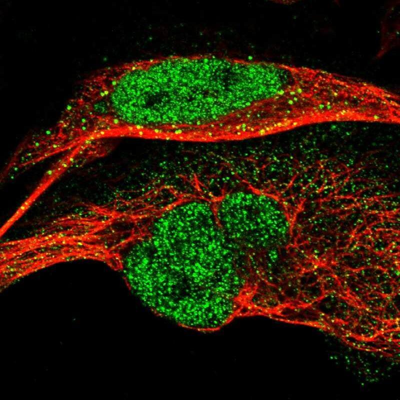Staining of human cell line U-2 OS shows localization to nucleoplasm & vesicles.